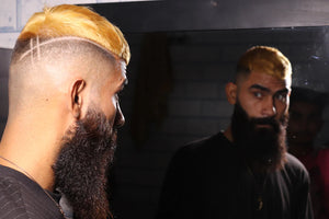 The Role of DHT in Hair Loss Understanding the Connection